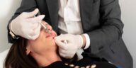 Microneedling ph Press